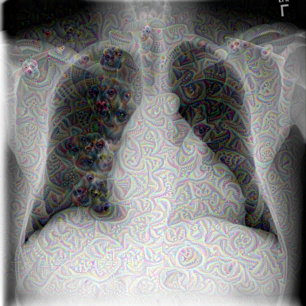 Chest X-Ray deep dreamed - our AI & deep learning future